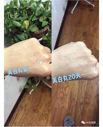 赫铂国际番茄美白 产品功效 1 天然的防晒霜 它能阻隔uva和uvb 使肌肤免受紫外线伤害2 天然的抗氧化剂 能对抗由环境造成的自由基侵害