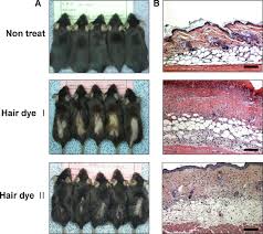 Each form provides different consistencies for the hair color and comes in four strengths: Hydrogen Peroxide And Monoethanolamine Are The Key Causative Ingredients For Hair Dye Induced Dermatitis And Hair Loss Journal Of Dermatological Science