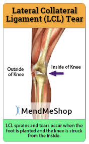 Torn Lcl Ligament Palpation And Observation Is Often The First Step In Diagnosing An Lcl Tear The Joint Wi Ligament Injury Ligament Tear Knee Injury Recovery