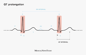 Image result for QT Interval