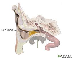 Another easy and effective way on how to clean your ears naturally is to use the combination of rubbing alcohol and white vinegar. Ear Wax Medlineplus Medical Encyclopedia