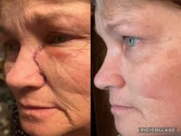 Best regime for age/sun spots