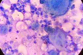 We did not find results for: Preco Vznika Pasovy Opar Aka Je Jeho Najefektivnejsia Liecba Zdravoteka