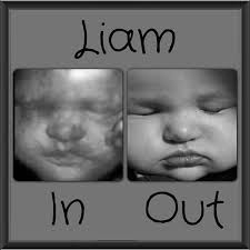 We just went yesterday at 31 weeks 4 days. Before And After 3d Ultrasound Images
