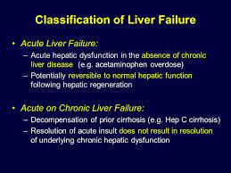 Advances In Extracorporeal Liver Support Ppt Video Online Download