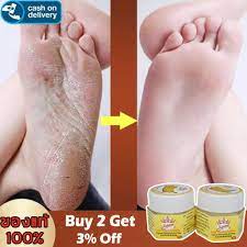 Ready To Stock Cod Cracked Heel Cream For Rough Dry Cracked Chapped Feet Remove Dead Skin Soften Foot Cracked Heal Repair Cream Foot Care Lazada