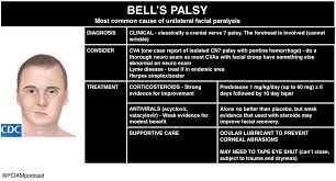 How to quickly tell them apart by looking at the faces of patientsподробнее. Bell S Palsy And Burns Foamcast