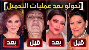 ‫فنانين تحول شكلهم ١٨٠ درجة بعد عمليات التجميل !! - YouTube‬‎