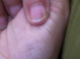 We did not find results for: I Have A Splinter Jammed Under My Fingernail Curltalk