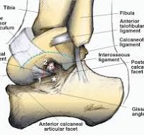 Quantitative Analysis of Subtalar Joint Motion With 4D CT ...
