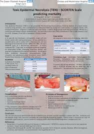 Image result for SCORTEN Score