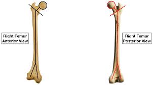 The end of the long bone is the epiphysis and the shaft is the diaphysis. Femur Bone Anatomy Labeled Diagram Quiz Color Coded Parts Skeletal System Lower Extremity Ezmed