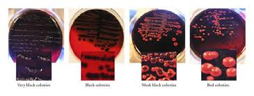 · 1.3 details of the supplier of the safety agar scientific ltd parsonage lane stansted cm24 8gf united kingdom. Figure 1 Prevalence Of Adhesion And Regulation Of Biofilm Related Genes In Different Clones Of Staphylococcus Aureus