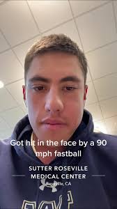 Hitting 90 Mph Baseball Pain Jaw