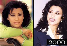 نجوى كرم كرم (najwā karam karam) profile: Ø¨Ø§Ù„ØµÙˆØ± Ù…Ø±Ø§Ø­Ù„ ØªØ·Ùˆ Ø± Ø¬Ù…Ø§Ù„ Ù†Ø¬ÙˆÙ‰ ÙƒØ±Ù… Ø¹Ø¨Ø± Ø§Ù„Ø³Ù†ÙŠÙ†