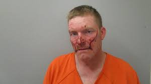 Alabama man arrested after biting off woman's finger, police allege