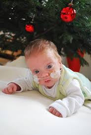 Ist dieser im wesentlichen funktionstüchtig, dann kommt eine magensonde zum einsatz (enterale ernährung). Dr Von Haunersche Nachsorgeeinrichtung Fur Fruhgeborene Und Kranke Neugeborene