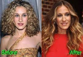 But, jessica parker needs more convincing words if . Sarah Jessica Parker Before And After Cosmetic Surgery Cosmetic Surgery Celebrity Plastic Surgery Plastic Surgery