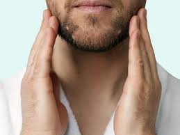 Image result for Alopecia