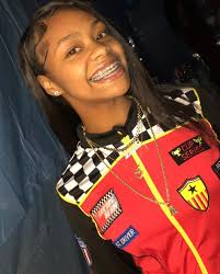 Pin On You Can Still Be Pretty With Braces Here Is Proof