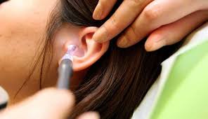 Telinga luar terdiri atas 3 bagian utama, yaitu aurikula (daun telinga), analis auditoris eksternal (saluran dari ketiga jenis tulang ini saling terkait satu sama lainnya dan dapat bergerak karena dihubungkan oleh persendian. 8 Cara Alami Mengatasi Infeksi Telinga Pada Anak Cantik Tempo Co