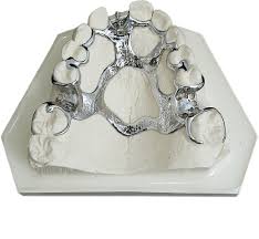Clasps are usually made from metal and will circle at least half of your adjoining teeth to partial dentures. Let S Talk About Wironium Cast Metal Partial Denture Frameworks Stomadent