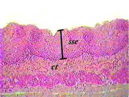 Maybe you would like to learn more about one of these? Stratified Squamous Non Keratinized Epithelium
