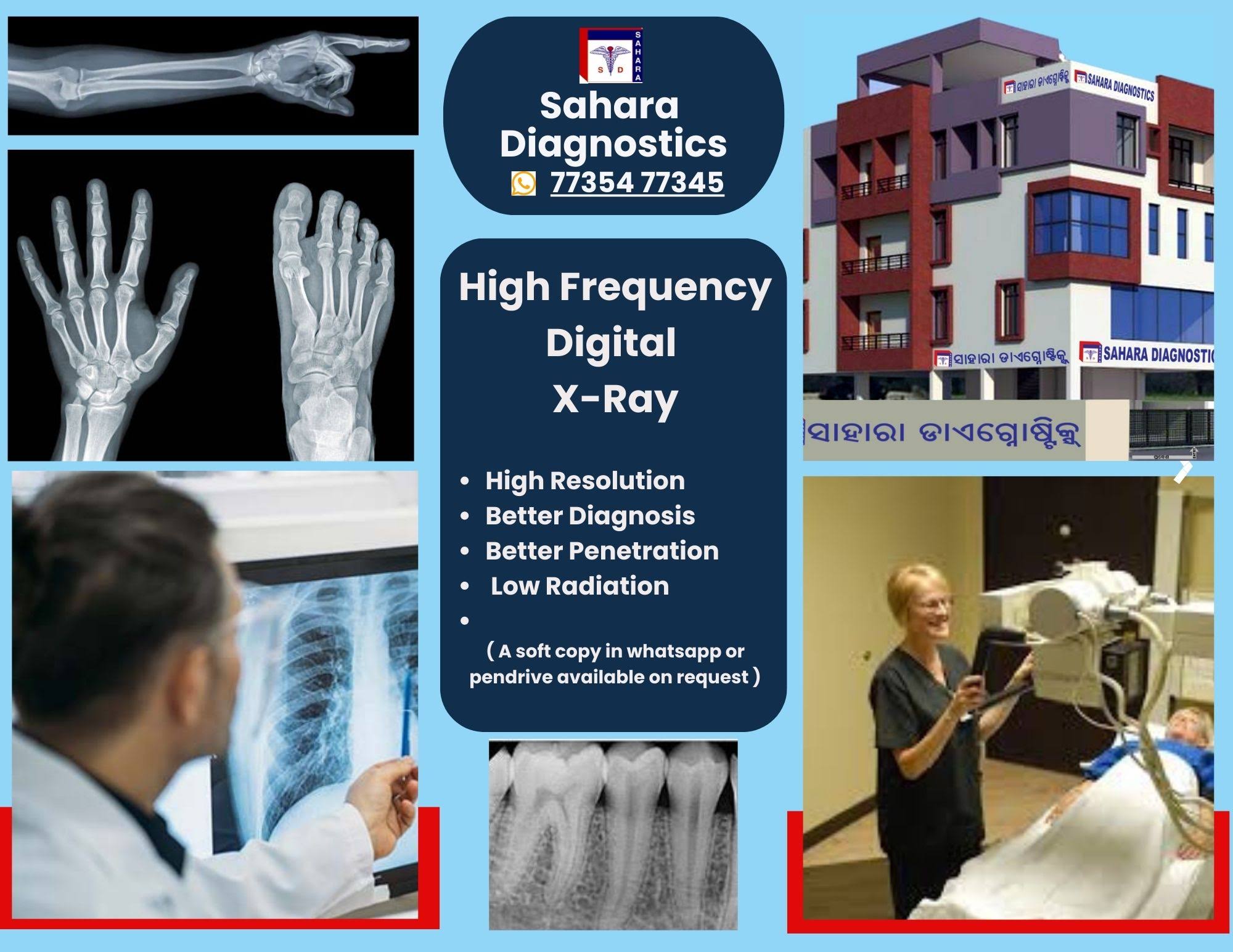 High Frequency Digital X-ray product image