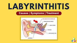 Image result for Bacterial Labyrinthitis