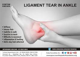 Symptoms For Ligament Tear In Ankle #Jointstreatment | Ligament Tear, Ankle  Surgery Recovery, Torn Ligament In Ankle