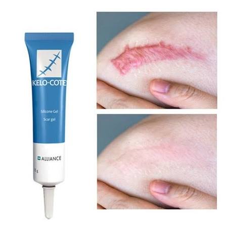 Sinclair Kelo-Cote Gel Scar Removal Medical Cream Brunei | Ubuy