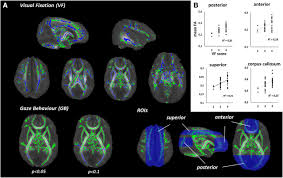 Image result for Visual Fixation