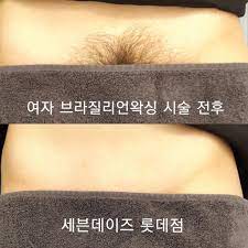 여자 브라질리언 왁싱 2배속 대음순 앵글 포커스, how to women brazilian waxing. 7days Lt ë¸Œë¼ì§ˆë¦¬ì–¸ì™ì‹± ì€ ì™ì‹±ì˜ ê½ƒì´ì£  ê´´ì •ë™ì™ì‹± ê´´ì •ë™ë¯¸ìš©ì‹¤ Facebook