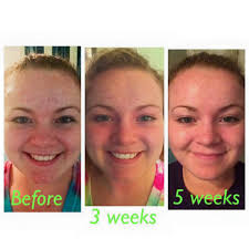 Rachel Patch, Independent Beauty Consultant