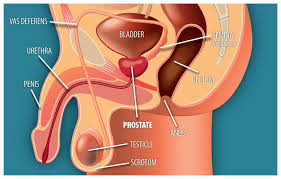 Treating Localized Prostate Cancer Comparative Effectiveness Review Summary Guides For Consumers Ncbi Bookshelf