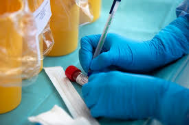Virus korona potvrđen kod 387 оsоba u RS, 26 smrtnih slučajeva - Virus  korona - BiH