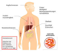 Legionellen kommen in fast jeder art von süßwasser vor, wobei grundwasser und ständig gekühltes trinkwasser eher selten befallen sind. Legionellen Die Typischen Symptome Der Legionarskrankheit Tabelle