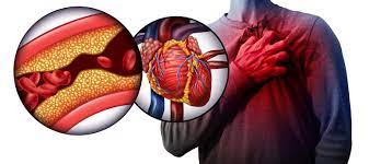 Causes of High Blood Pressure and the Ways to Prevent It