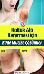Nigar Bekar Adli Kullanicinin Pratik Bilgiler Panosundaki Pin 2020 Koltuk Alti Cilt Bakimi Organik Cilt Bakimi