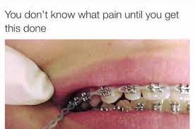 21 Tweets About Having Braces That Are Way Too Real Cute Braces Brace Face Braces Tips