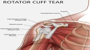 The human shoulder is made up of three bones: Rotator Cuff Repair Surgery Hospitals Surgeons Cost Medcureindia