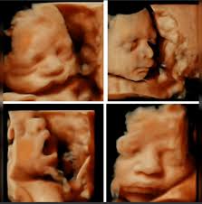 Dr. Franco Ruiz Flores Velasquez Ginecólogo,