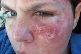 Fundraiser by Cheryl Vocu-Bales : Sarah's Trials