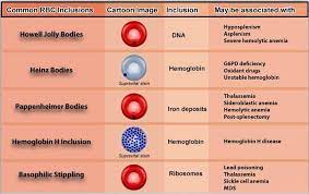 For women, 4.2 to 5.4 million red blood cells per microliter of blood Variations In Red Blood Cell Morphology Size Shape Color And Inclusion Bodies Laboratoryinfo Com