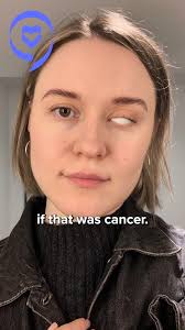 Ben's journey with myeloproliferative neoplasms (MPNs) began with a  diagnosis of essential thrombocythemia in 2012. He talks about the  importance of people advocating for themselves during treatment. Watch his  full story at