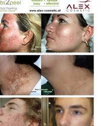 Grace Nardelli (@elegraspa) · Montreal, QC