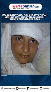 Keajaiban Teknologi! Audrey Kembali Menulis Setelah 20 Tahun Lumpuh, Hanya  dengan Chip Otak