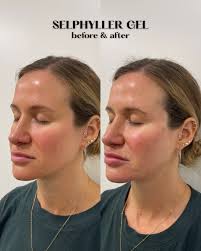 A couple days belated but with infinite gratitude, love, trust, and  respect, I wish a HAPPY NATIONAL DOCTORS DAY 🔥👩🏻‍⚕️ to these incredible  women and friends @richmondderm Dr Melissa King, Dr Victoria