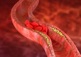 Also, when the blood does not circulate correctly, oxygen and nutrients cannot reach tissues effectively, which can result in stiffness. Poor Circulation Causes Signs And Symptoms And Treatment Cardiovascular Disorders And Diseases Medical Answers Body Health Conditions Center Steadyhealth Com