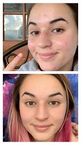 Looking for a cleanser and moisturiser for dry skin that is prone to  hormone break outs. I don't mind spending a few dollars